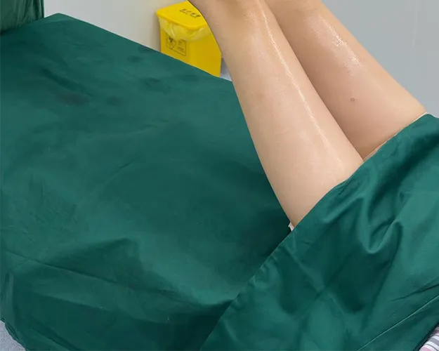腿部塑形